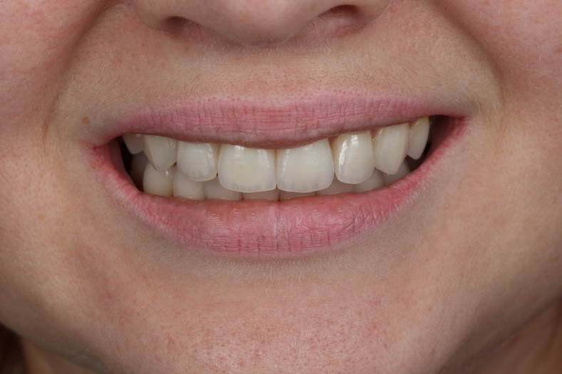 Smile story andrii